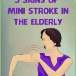 Stroke: These indicators that manifest one month prior to..