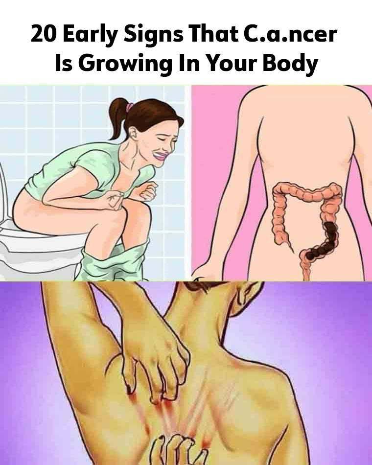 20 Early Signs Your Body is Fighting Cancer