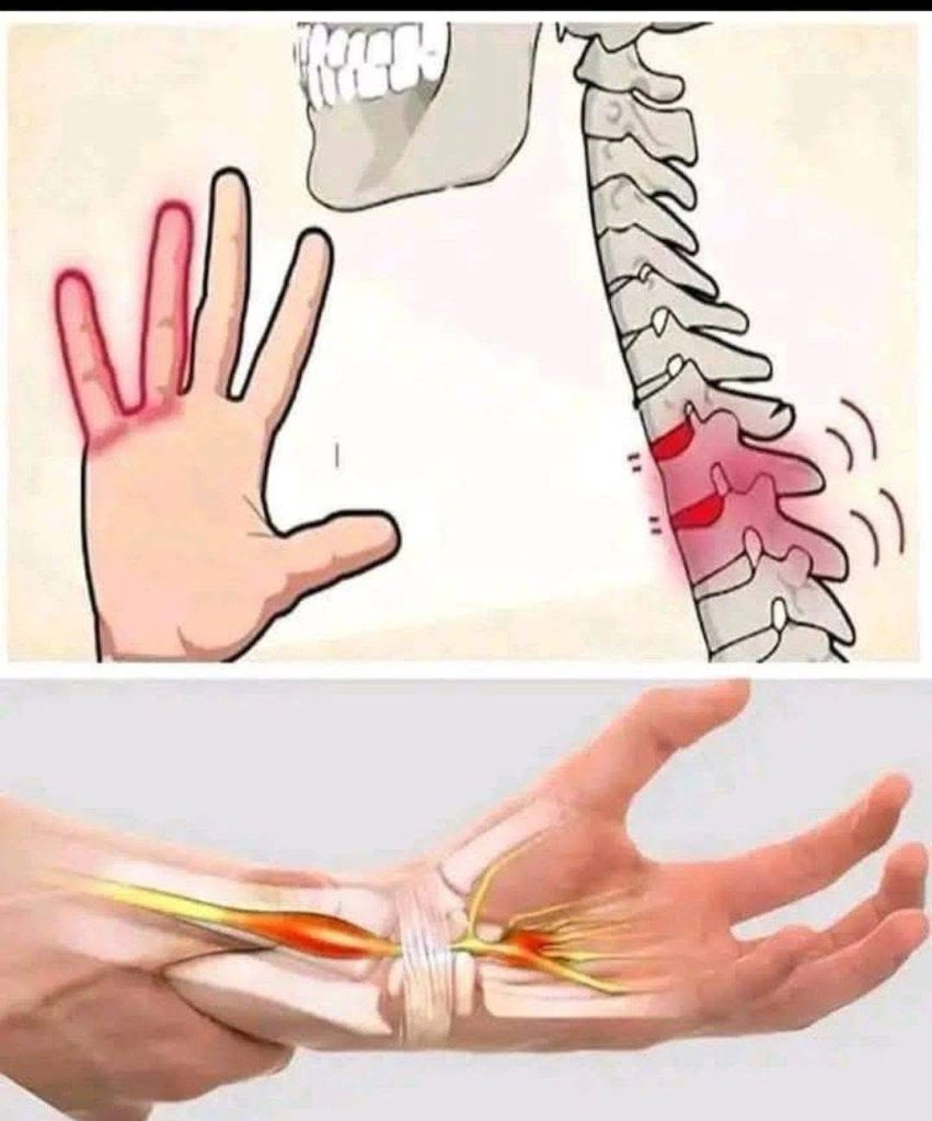 Tingling Sensation In Your Body: Why Does It Happen