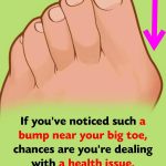 The painful bump on the side of your feet