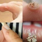 BE VERY CAREFUL. If you get this, you are infected with….