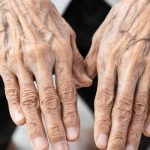 If you see someone with bulging veins, you must tell them these things