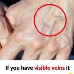 If you see someone with bulging veins, you must tell them these things
