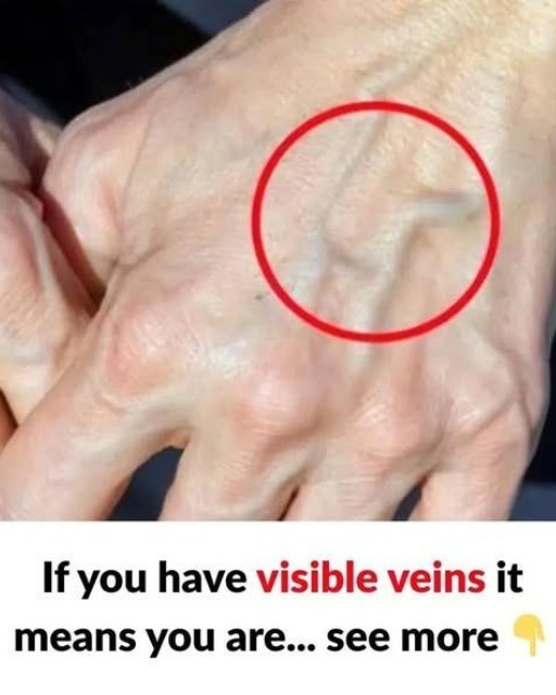 If you see someone with bulging veins, you must tell them these things