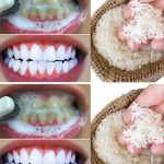Brighten your smile naturally: Tomato teeth whitening