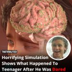 Horrifying Simulation Reveals What Happened To A Teenager After His Friends Dared Him To Eat A Live Slug