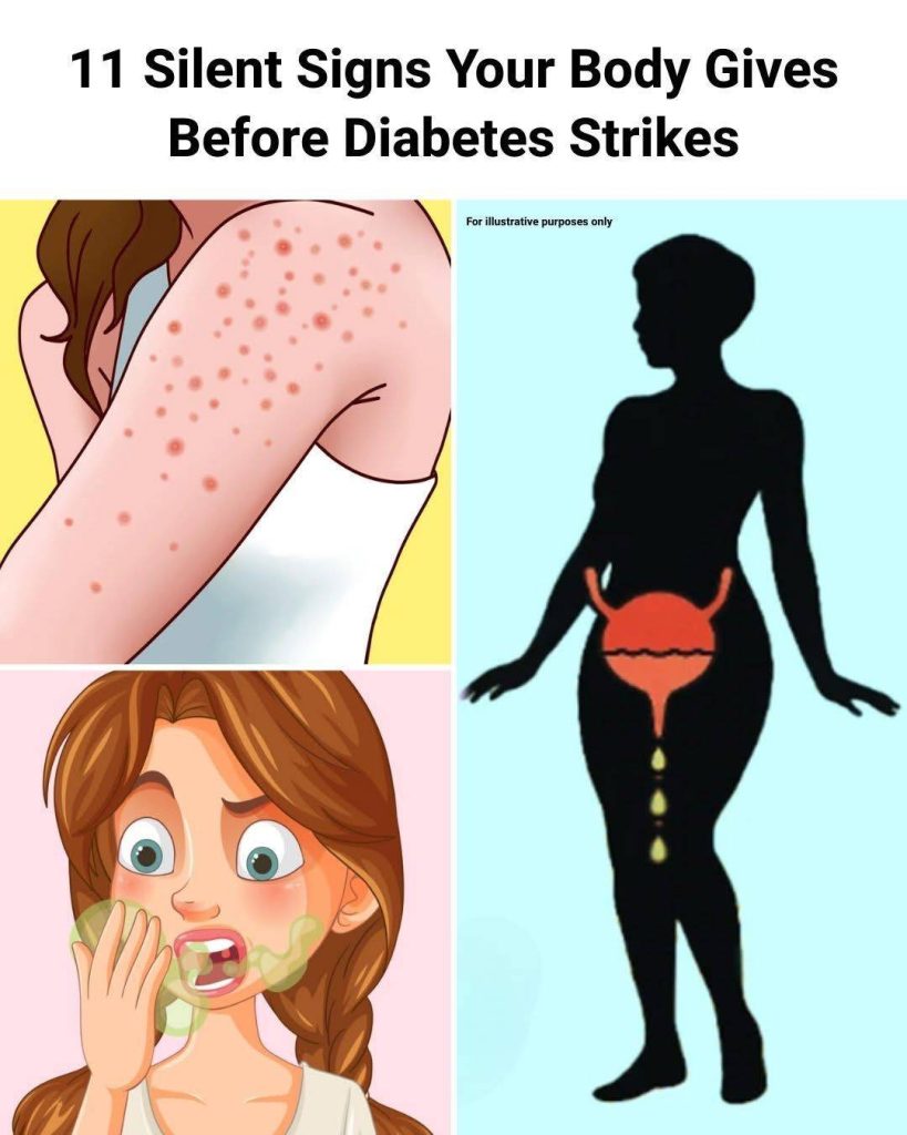 9 Early Signs of Diabetes You May Not Be Noticing