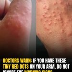 If You Have These Tiny Red Dots On Your Arm, Do Not Ignore The Warning Signs