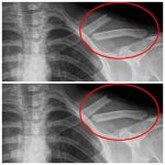 You drink this poison every day, even though it breaks down your bones. You had no idea about this!