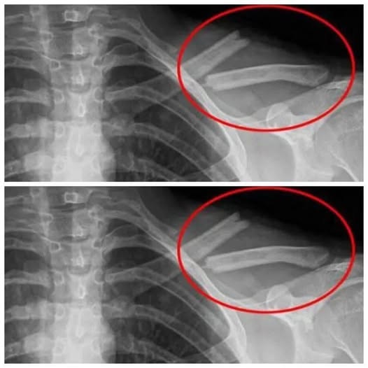 You drink this poison every day, even though it breaks down your bones. You had no idea about this!